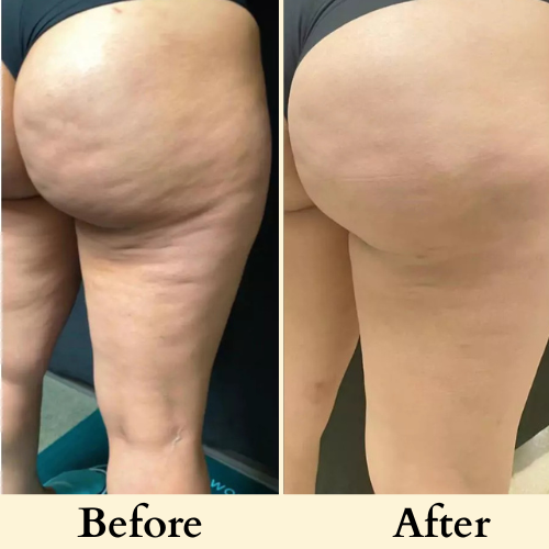 Elure. Anti Cellulite Massage Oil